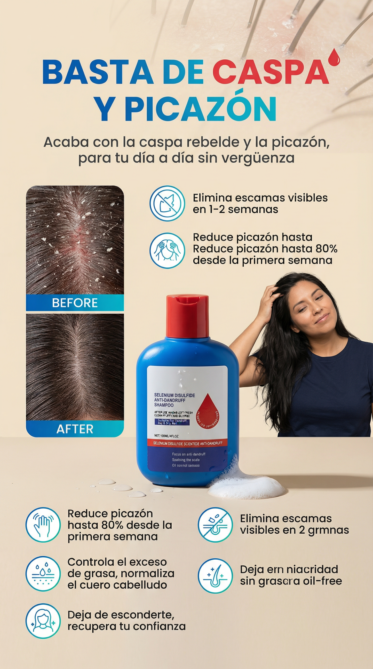 ELIMINA LA CASPA DESDE LAS PRIMERAS APLICACIONES